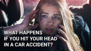 what-happens-if-you-hit-your-head-in-car-accident