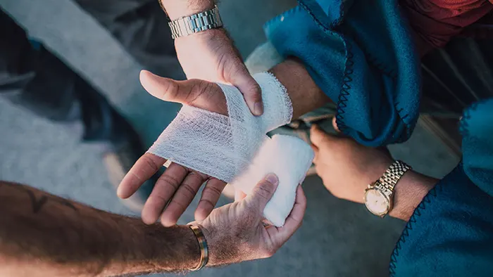 Burn Injury Compensation in New Jersey