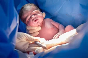 img practice birth injury